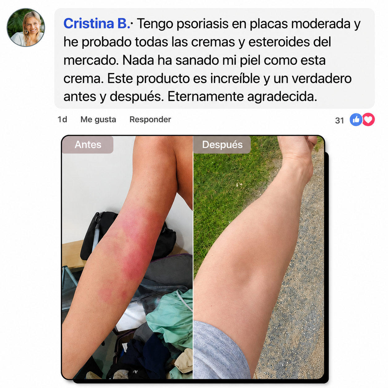 Crema Natural para Piel Atópica, Seca e Irritada