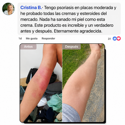 Crema Natural para Piel Atópica, Seca e Irritada
