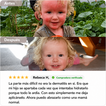 Crema Natural para Piel Atópica, Seca e Irritada