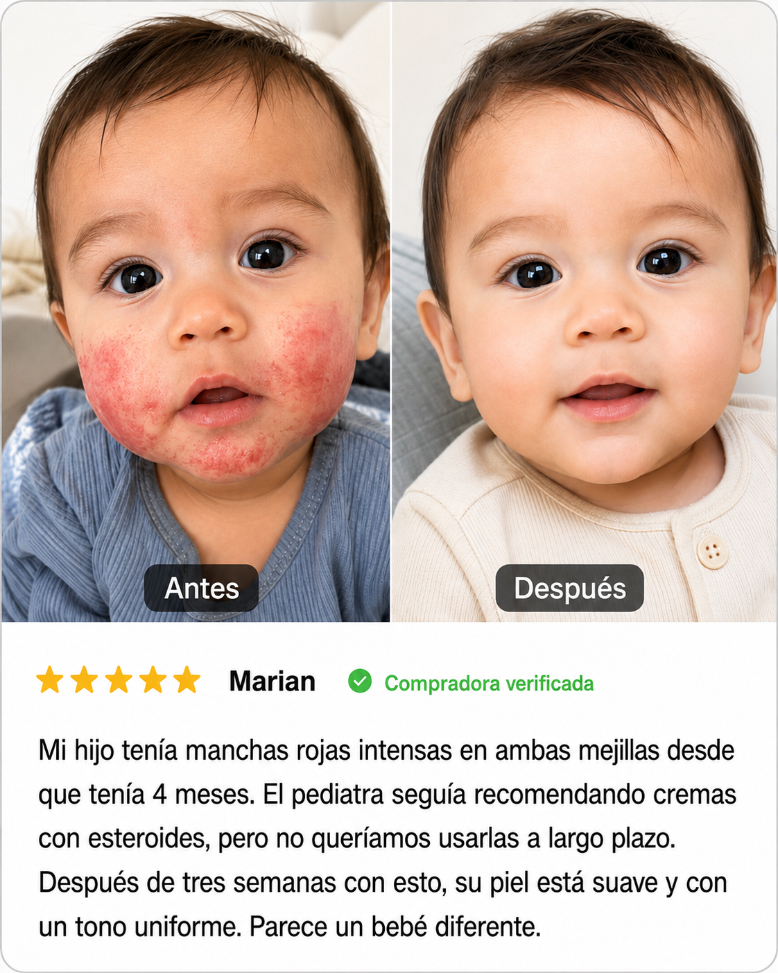 Crema Natural para Piel Atópica, Seca e Irritada