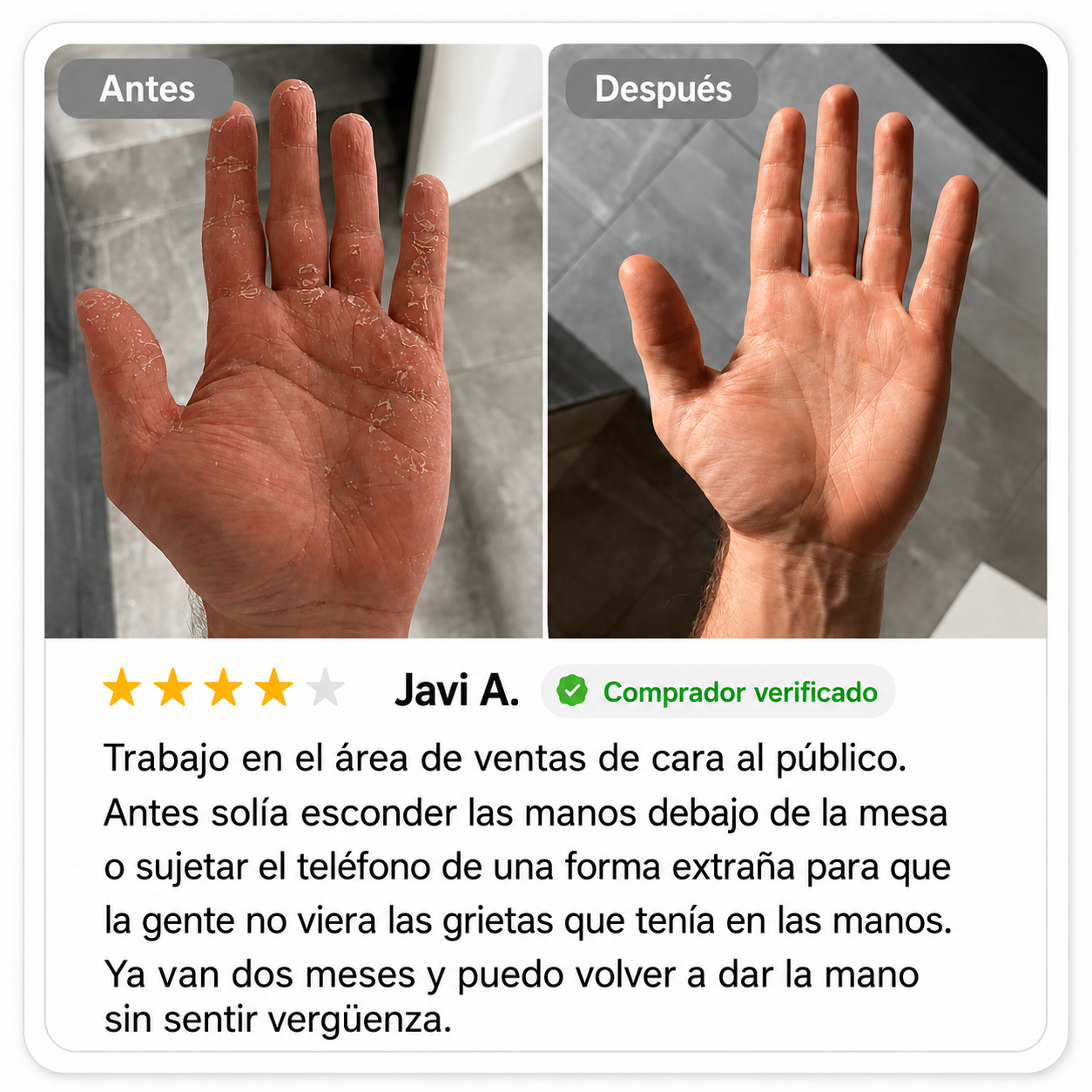 Crema Natural para Piel Atópica, Seca e Irritada