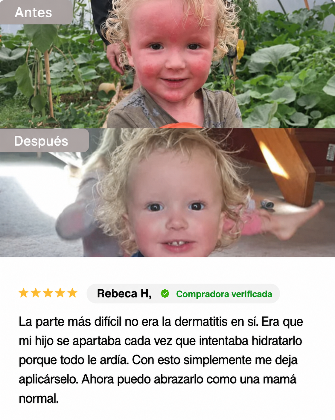 Crema Natural para Piel Atópica, Seca e Irritada