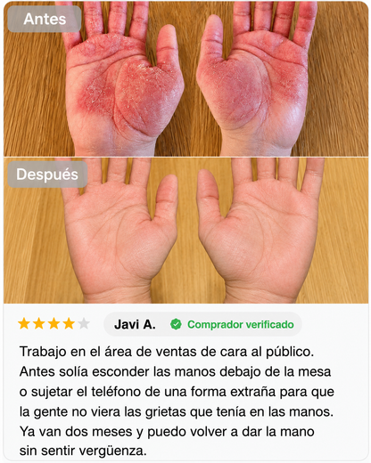 Crema Natural para Piel Atópica, Seca e Irritada