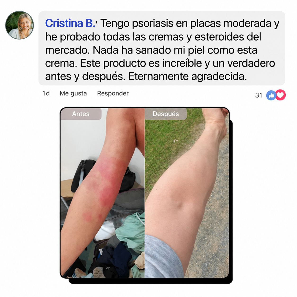 Crema Natural para Piel Atópica, Seca e Irritada