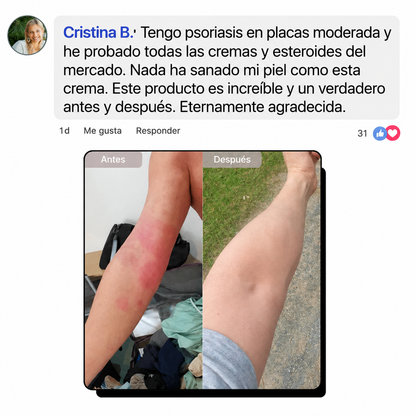 Crema Natural para Piel Atópica, Seca e Irritada