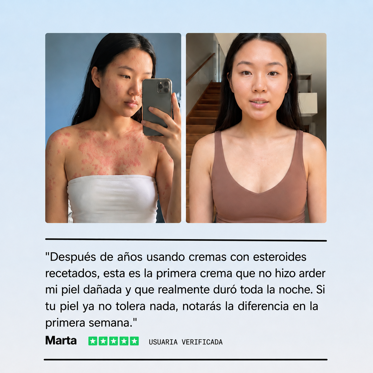 Crema Natural para Piel Atópica, Seca e Irritada