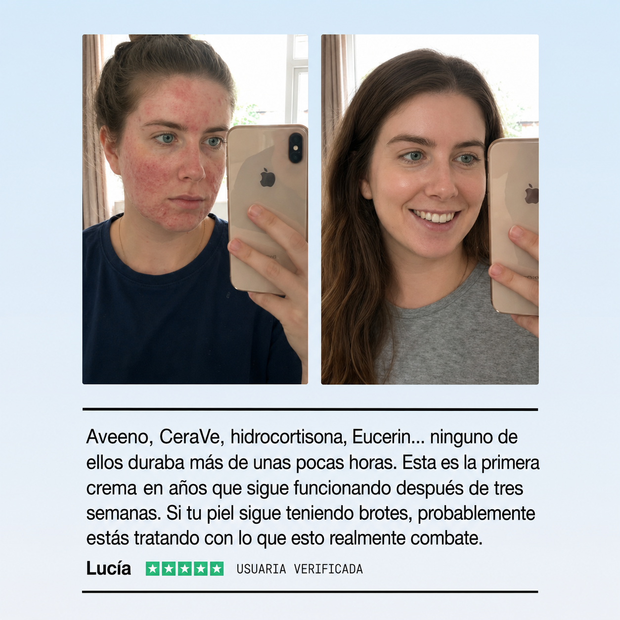 Crema Natural para Piel Atópica, Seca e Irritada