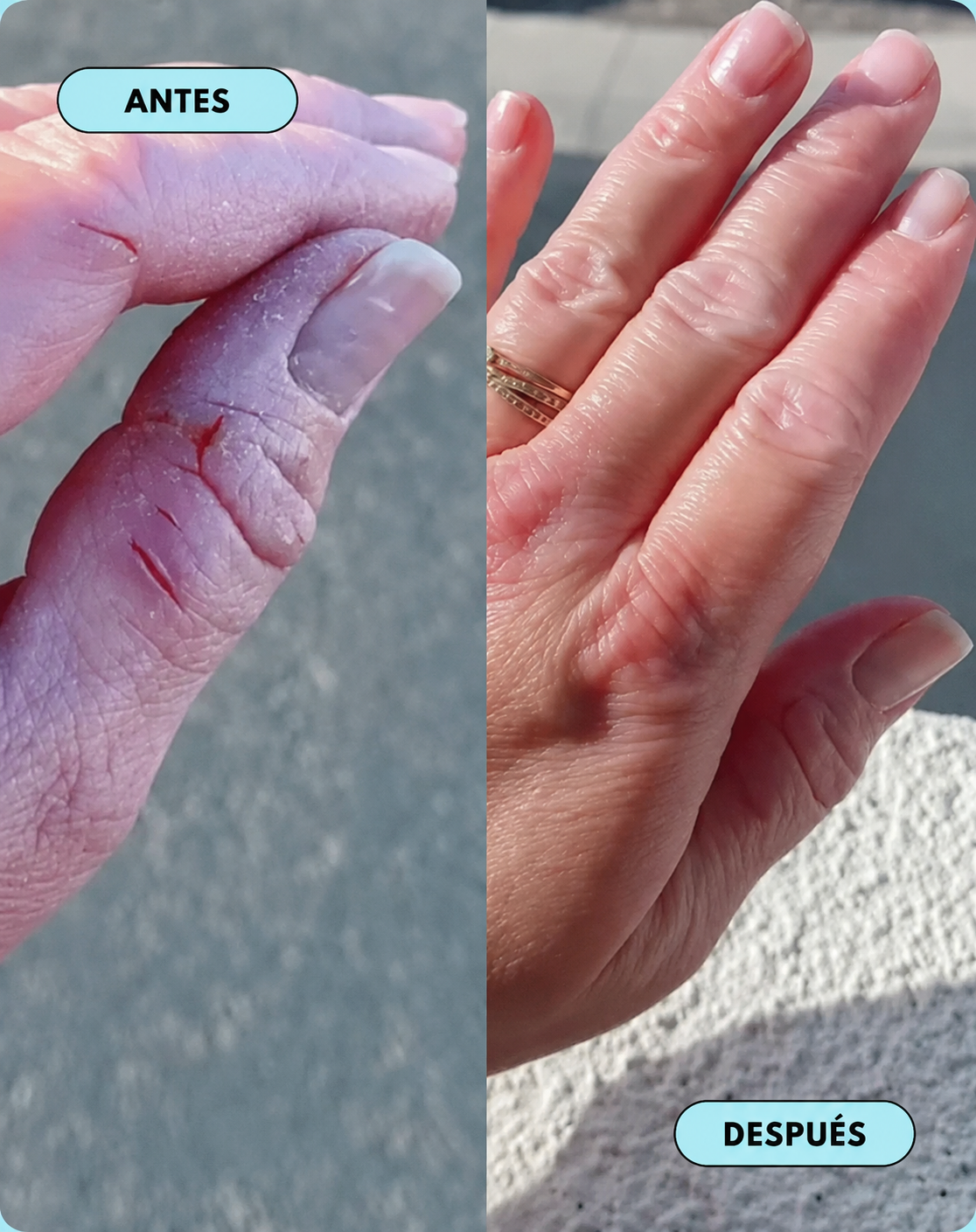 Crema Natural para Piel Atópica, Seca e Irritada