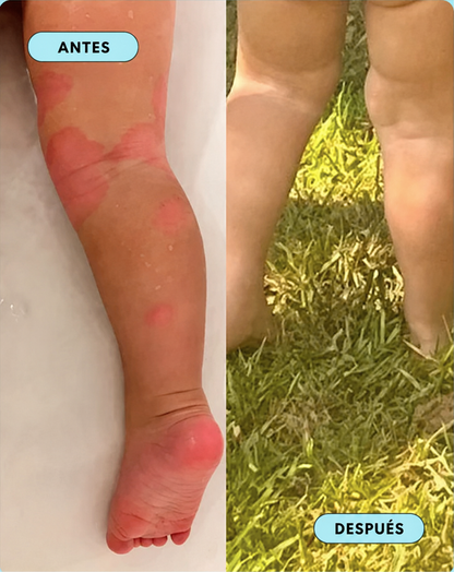 Crema Natural para Piel Atópica, Seca e Irritada